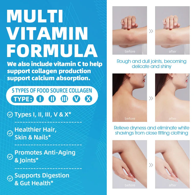 Collagen Capsules with Hyaluronic Acid ,Biotin and Vitamin C for Hair,Skin,Nails for Women & Men Anti-Aging Support Immune System and Digestive Health